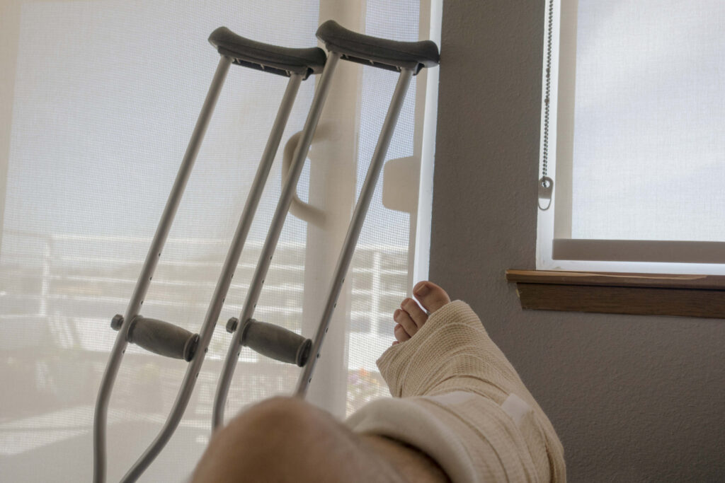 The “90/180 Day” Rule: Suing Even Without a Broken Bone