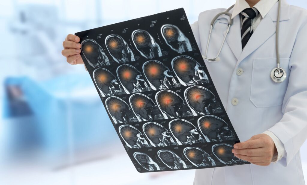 Imagen digital de actividad cerebral utilizada en debates Frye sobre evidencia médica en casos de lesiones cerebrales en NY