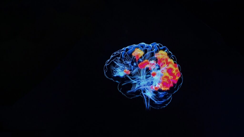 Médico sosteniendo escáner cerebral utilizado como evidencia en litigios de lesión cerebral traumática en Nueva York
