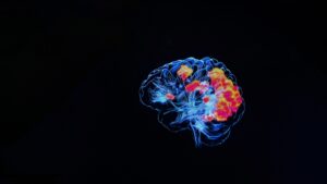 Médico sosteniendo escáner cerebral utilizado como evidencia en litigios de lesión cerebral traumática en Nueva York