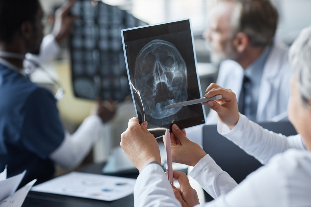 Doctors reviewing a skull X-ray to diagnose a traumatic brain injury
