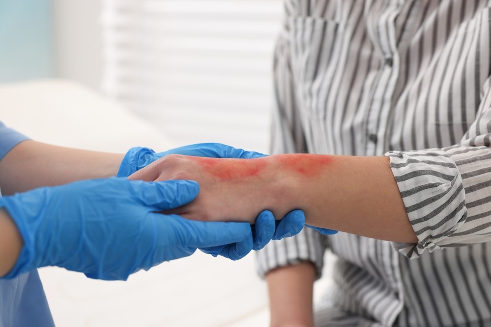 Doctor examining a burn injury on a patient's arm in New York